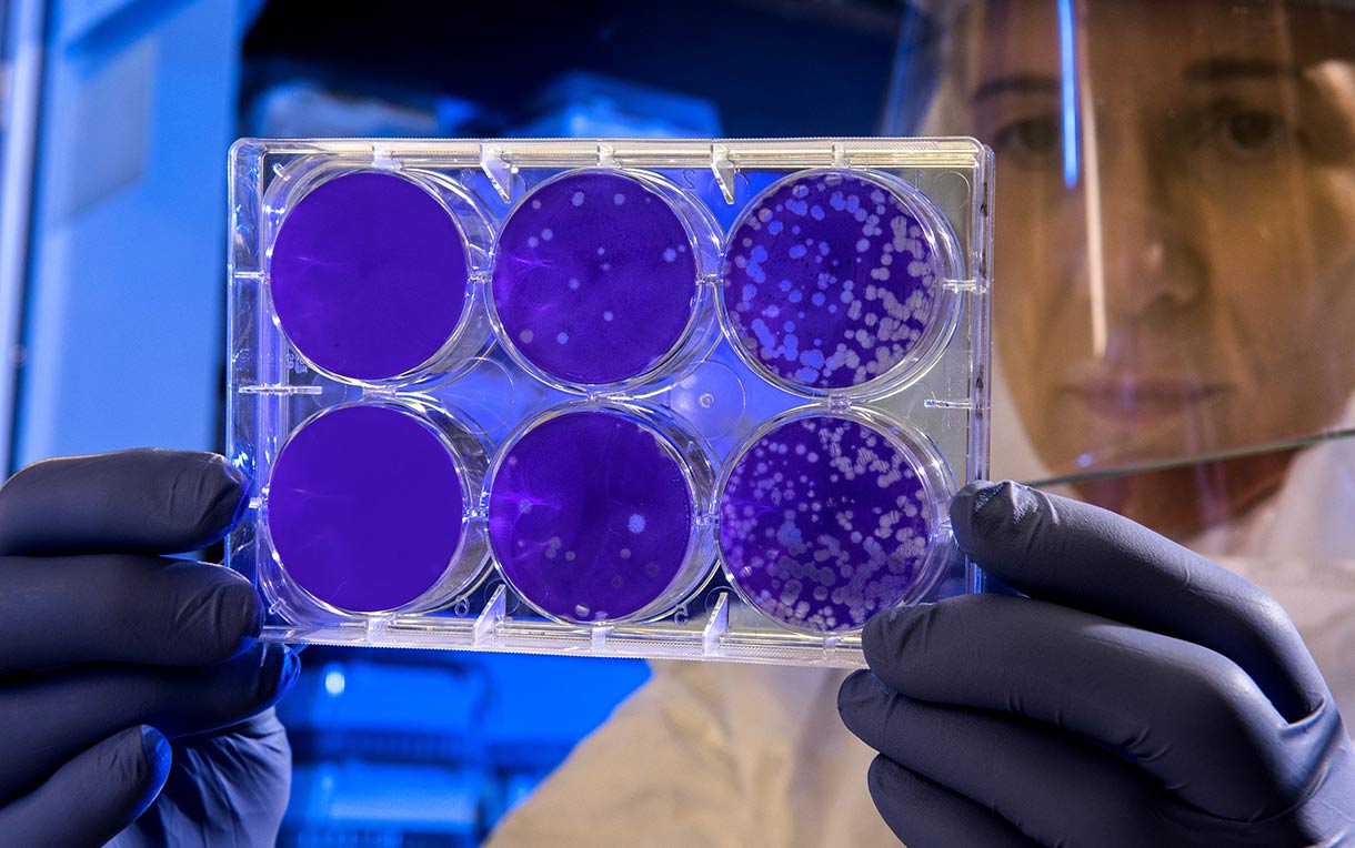 Scientist examines the result of a plaque assay.